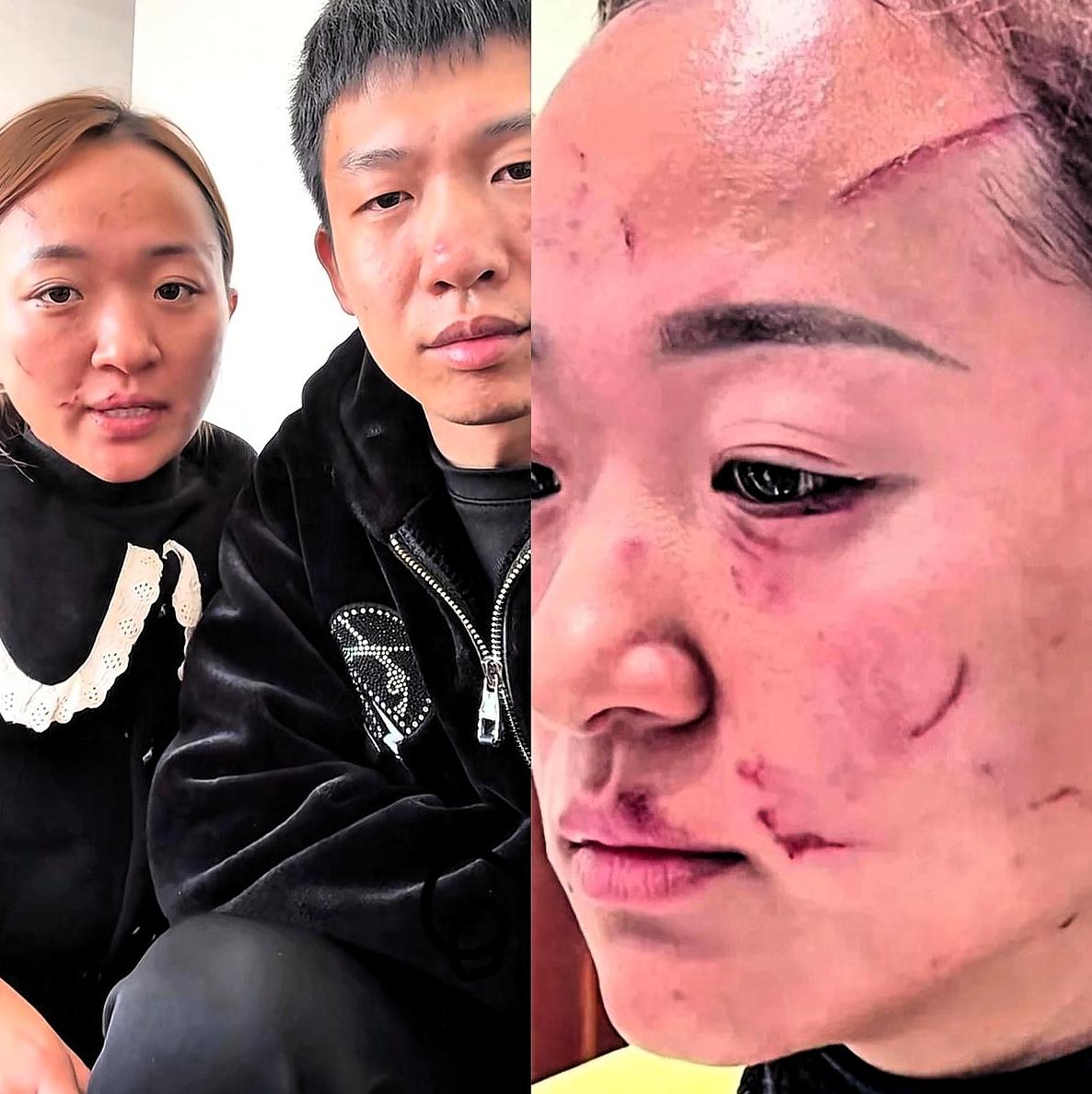 5万买断婆媳情？这调解结果看着痛快，实则藏着最无奈的家庭真相！
 
别纠结谁伤得