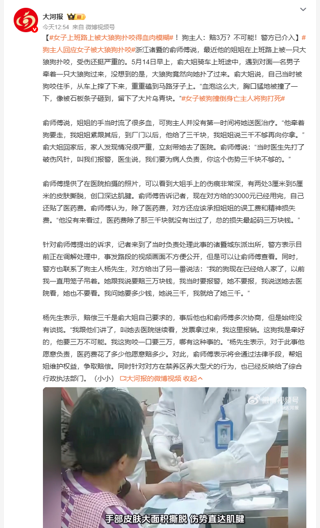 女子上班路上被大狼狗扑咬得血肉模糊 诸暨俞大姐上班途中被大狼狗扑咬摔倒，手部创口