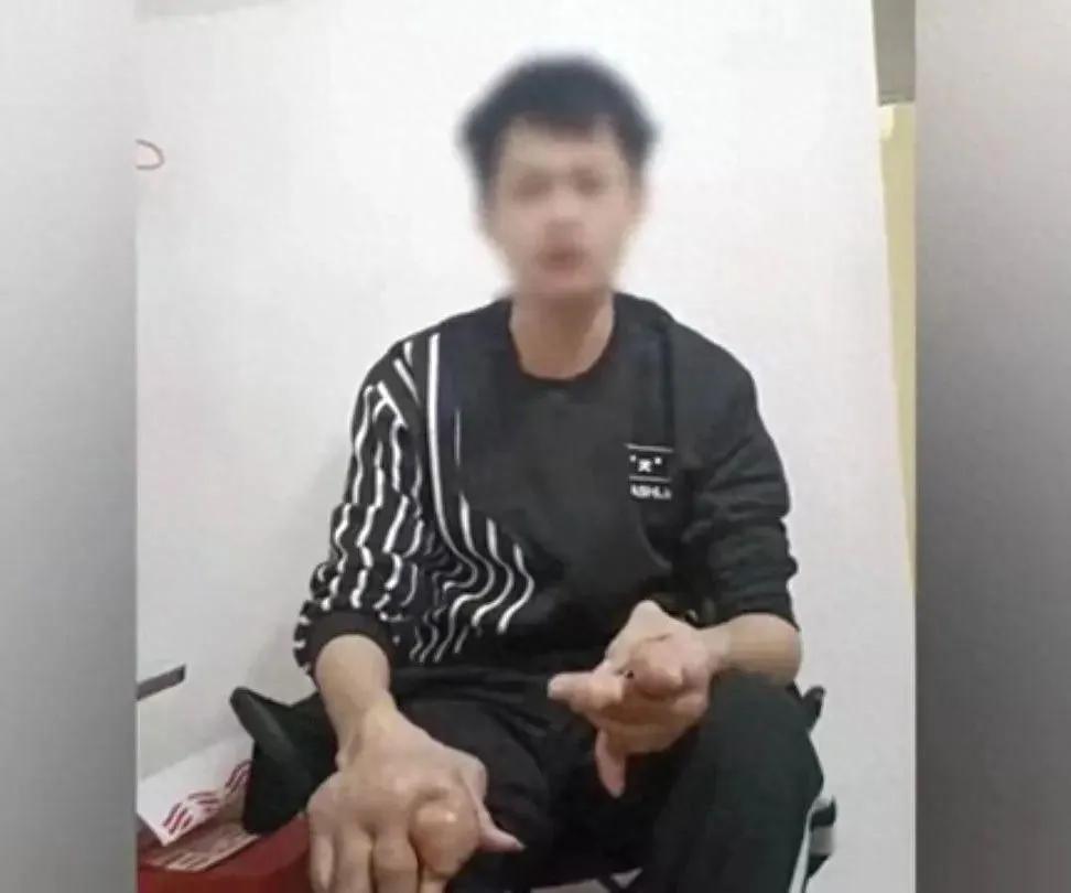 广东一小伙患上“不死的癌症”，年轻人的坏习惯一定得改！

近日，广东东莞的蓝先生