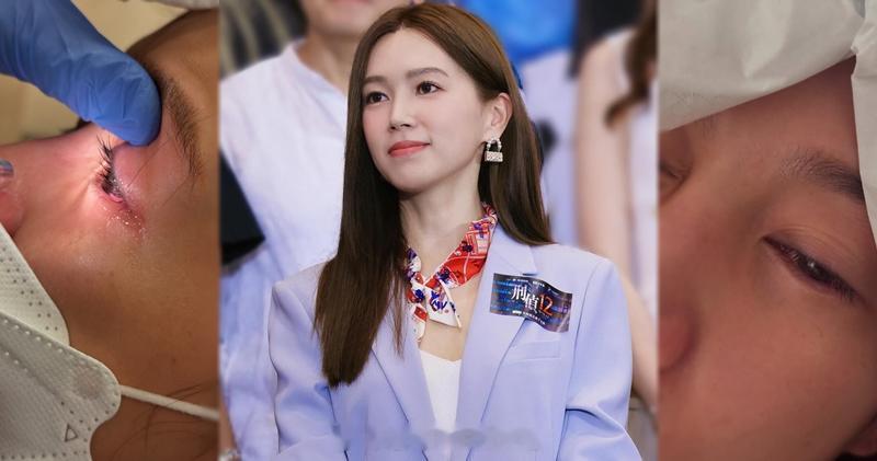 明报：傅嘉莉眼角膜受伤 病情恶化需再入院：处理不当会变严重溃疡40岁的傅嘉莉（K