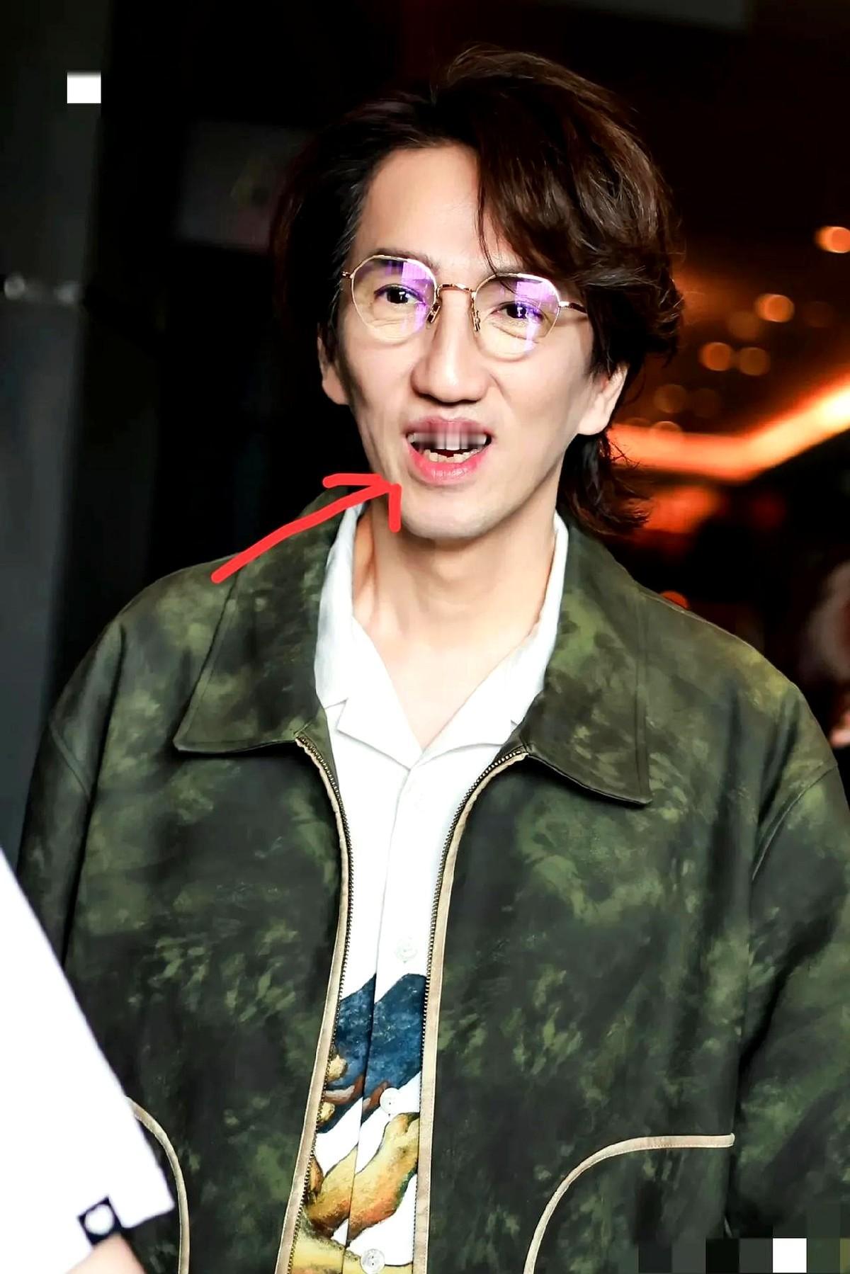 林志炫为什么火不起来？
原因很简单啊。
他自身有一个很严重的问题，那就是长相很不
