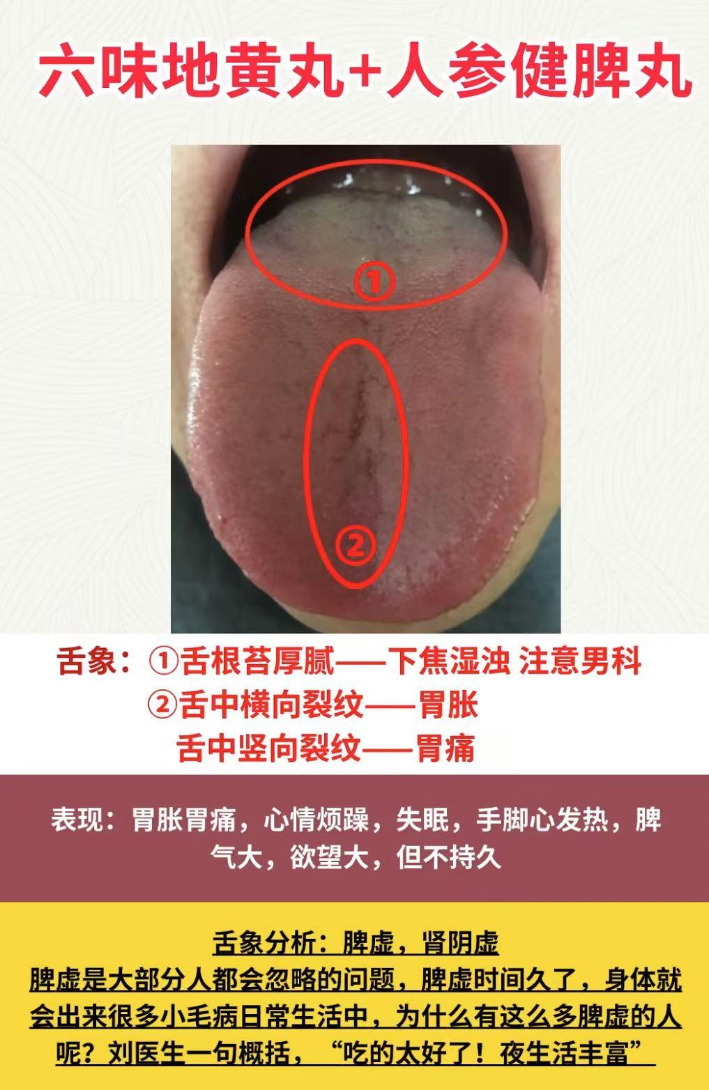 六味地黄丸+人参健脾丸
杞菊地黄丸+参苓白术散
一起服用效果更好！
#中医##科