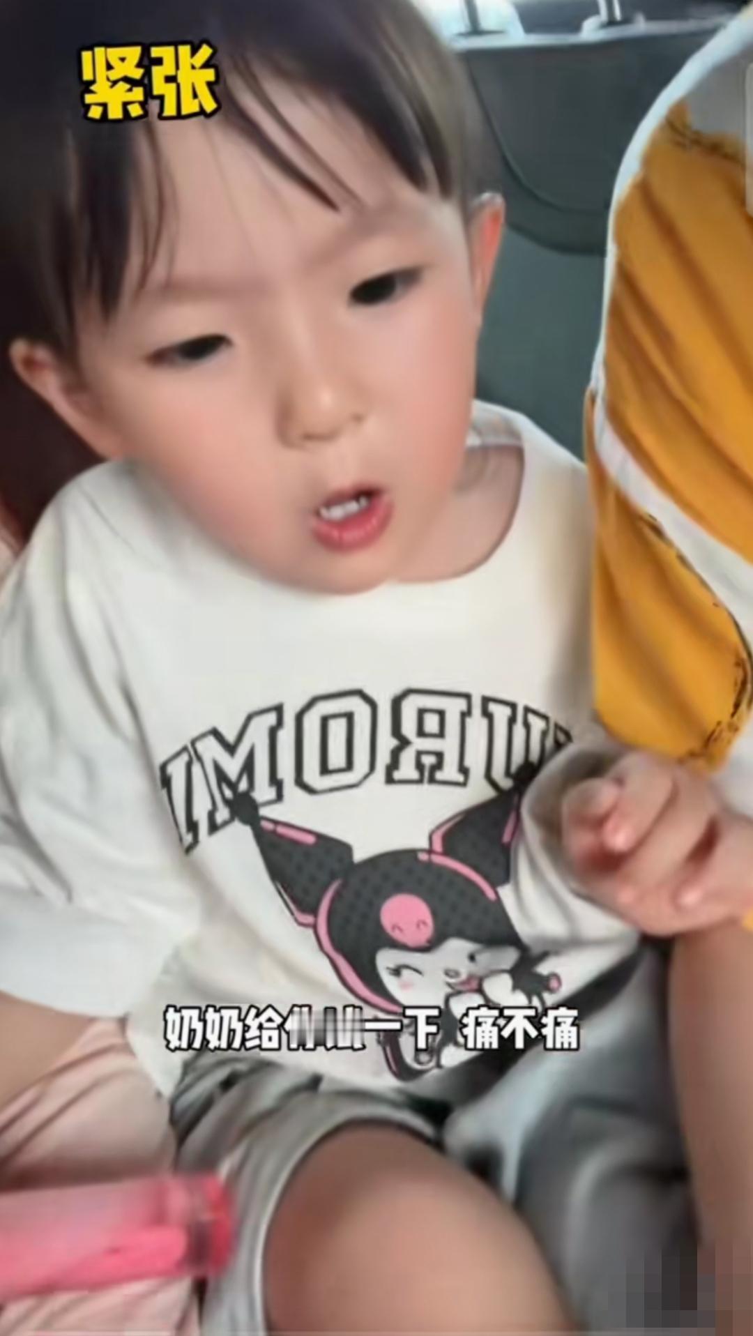 闪闪陪黄一鸣在海边卖了一上午芒果，收工后发现闪闪脚上磨出了一个大大的水泡！

闪