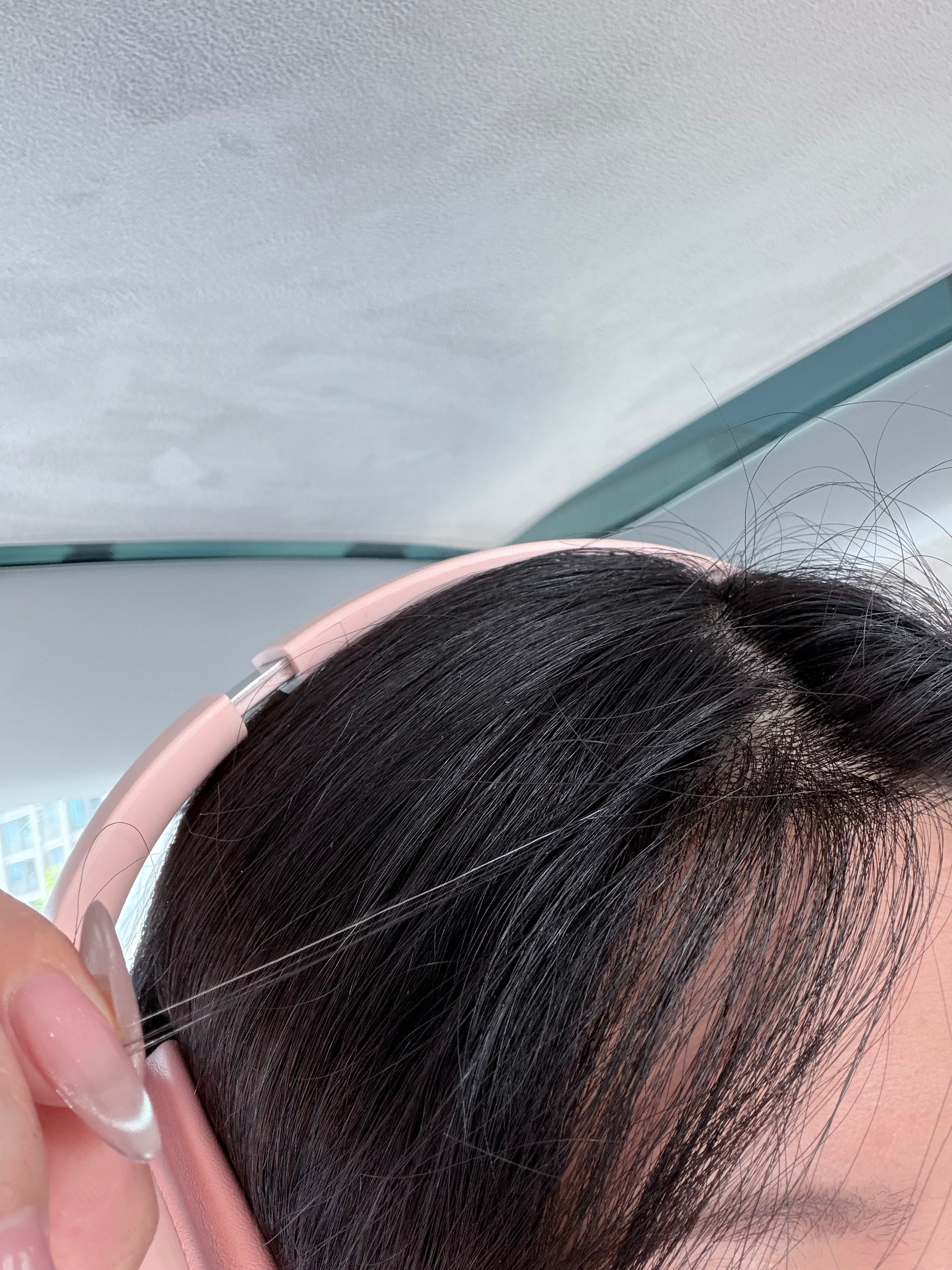 已经变白的头发又返黑了 