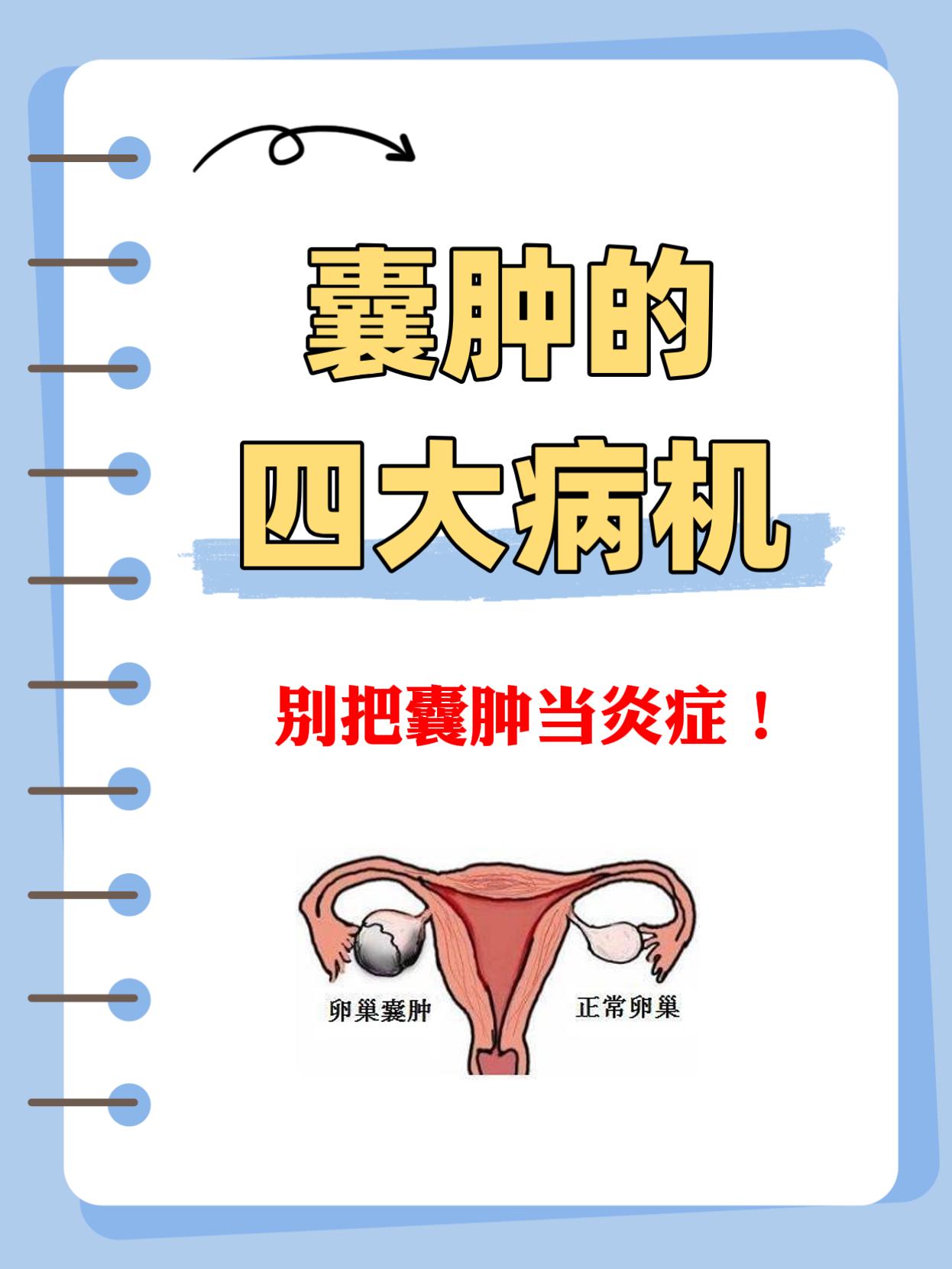 有囊肿怎么调？这4 种证型教你自查！。