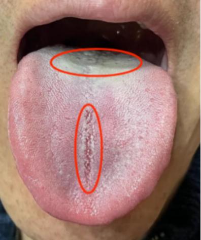 下午继续，伸舌我看！全程不收费！一个不漏，1分钟告知病因和调理方向！房事不行别乱