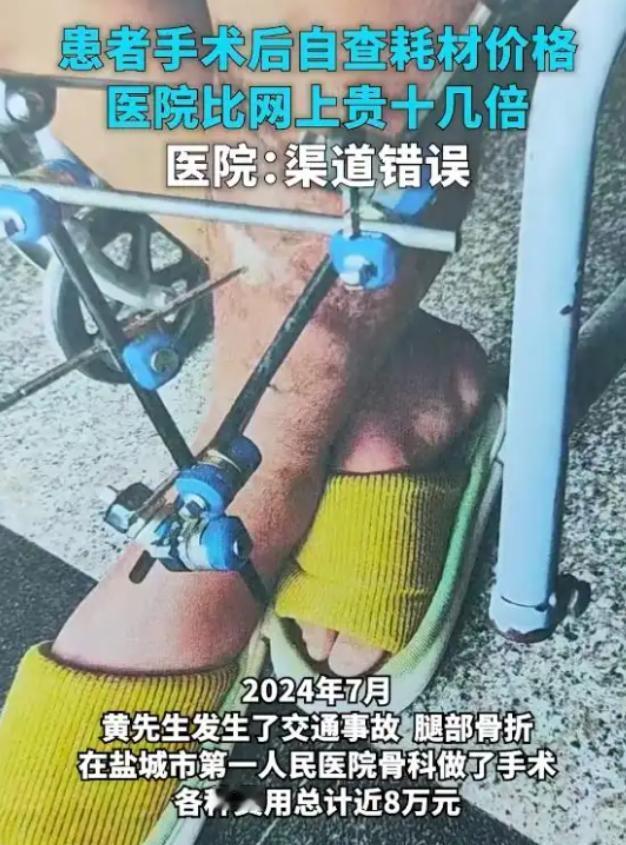 江苏盐城，黄某在手术后查看医疗账单时，发现其中一项外固定支架的费用异常高。根据收