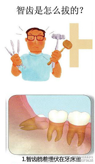 【智齿是怎么拔的？看完直冒冷汗】①智齿躺着埋伏在牙床里；②用手术刀切开牙床；③露