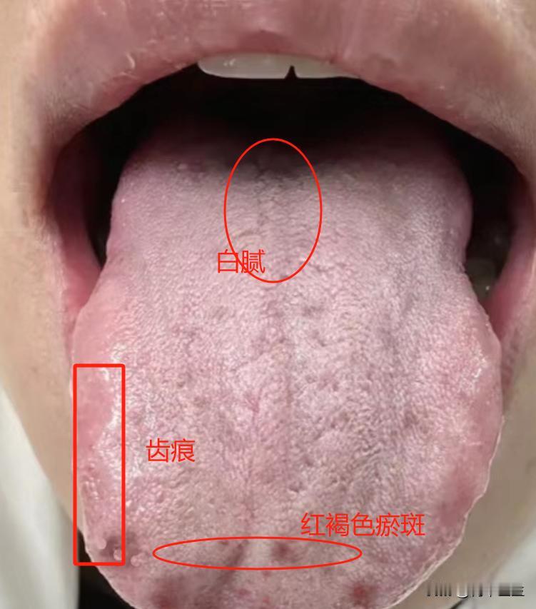 经典好方加上这几味药，镇静安神、疏气解瘀，专治失眠

“我睡不好已经有十多年了，