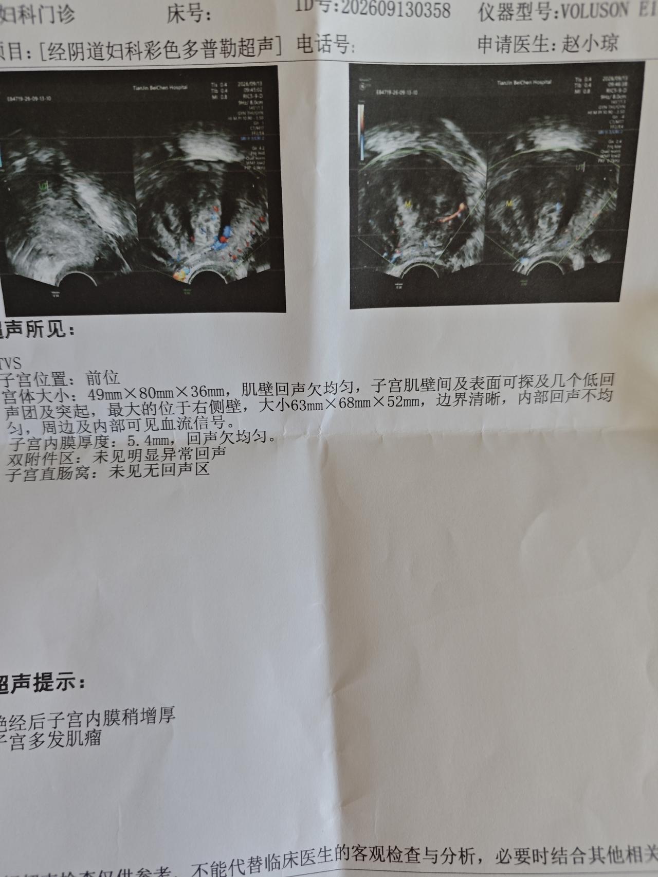 真是愁死人了，都六十多岁了，这个子宫肌瘤还没有萎缩。

今天又去医院做了彩超检查