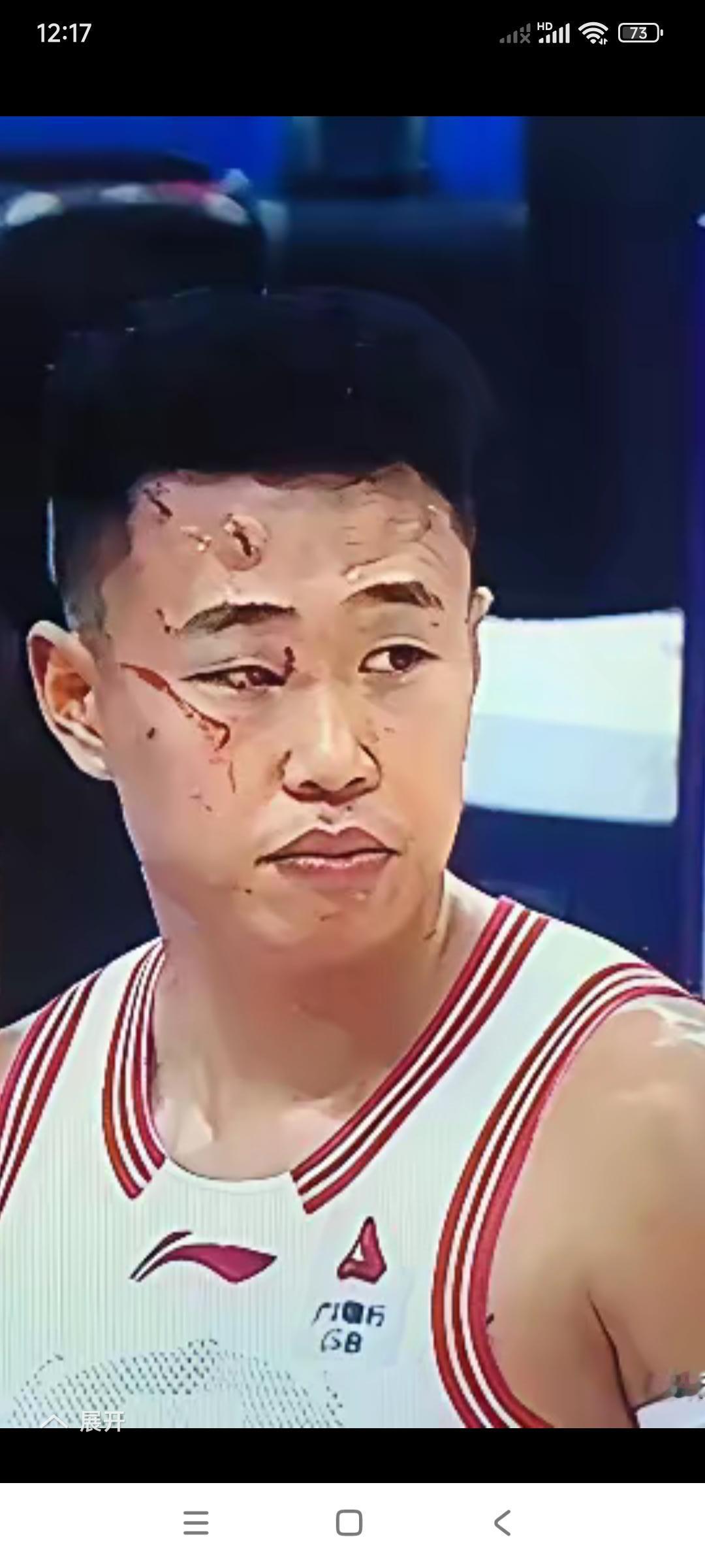 这是哪个瘟灾的给挠的？

这是真挠啊，太恨人了。

你把那篮球儿挠破了，挠碎了，