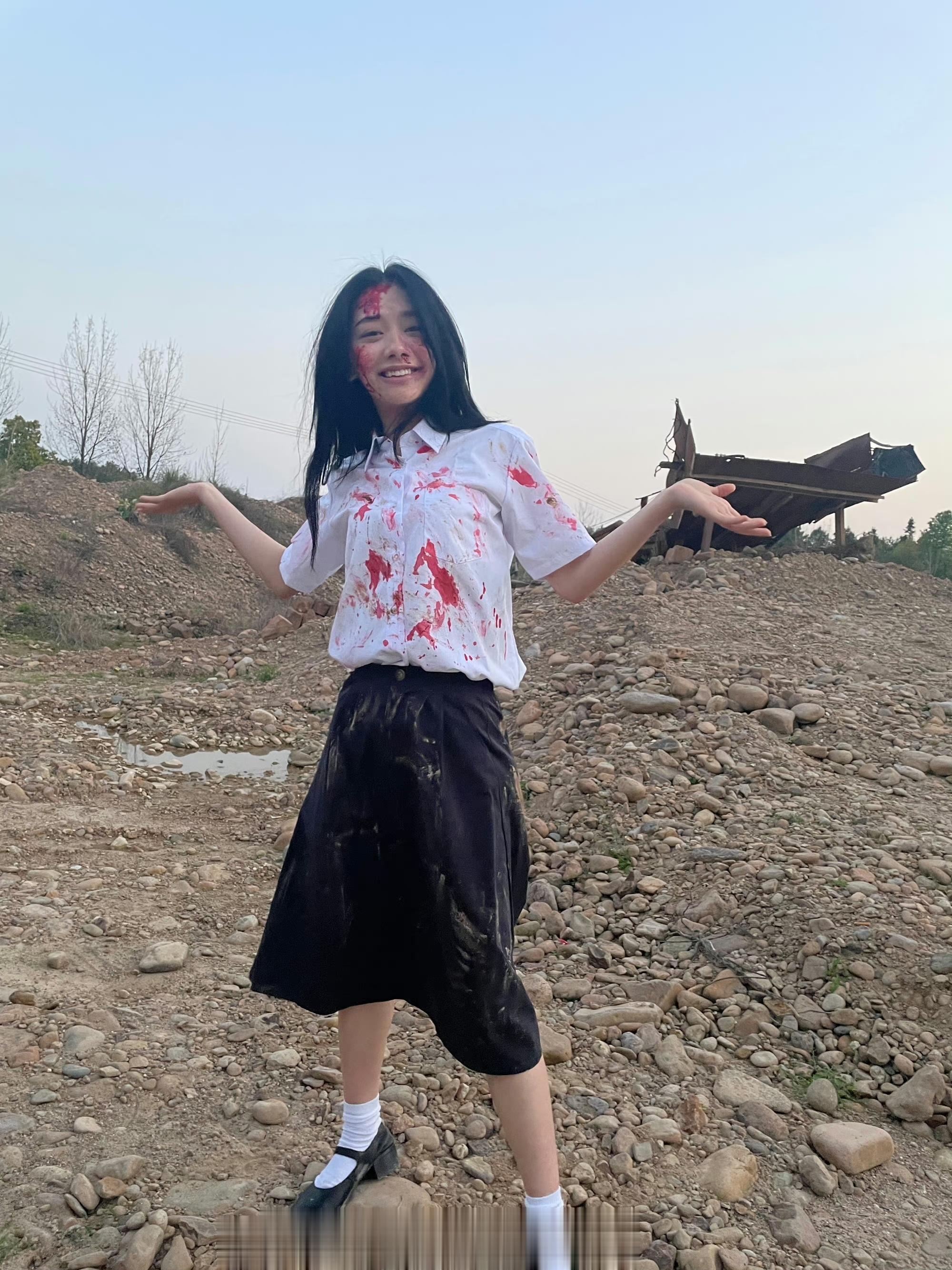#王影璐晒战损版冯宝宝花絮照#好家伙，怎么受伤了还能笑的这么开心，这个花絮怎么这