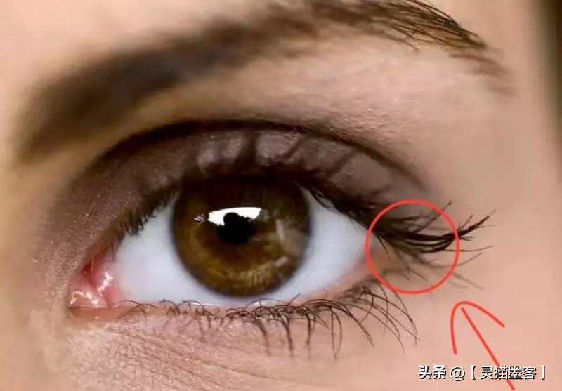 右眼角痛可能由多种原因引起，包括眼部感染、炎症、外伤、过敏反应、干眼症、青光眼等