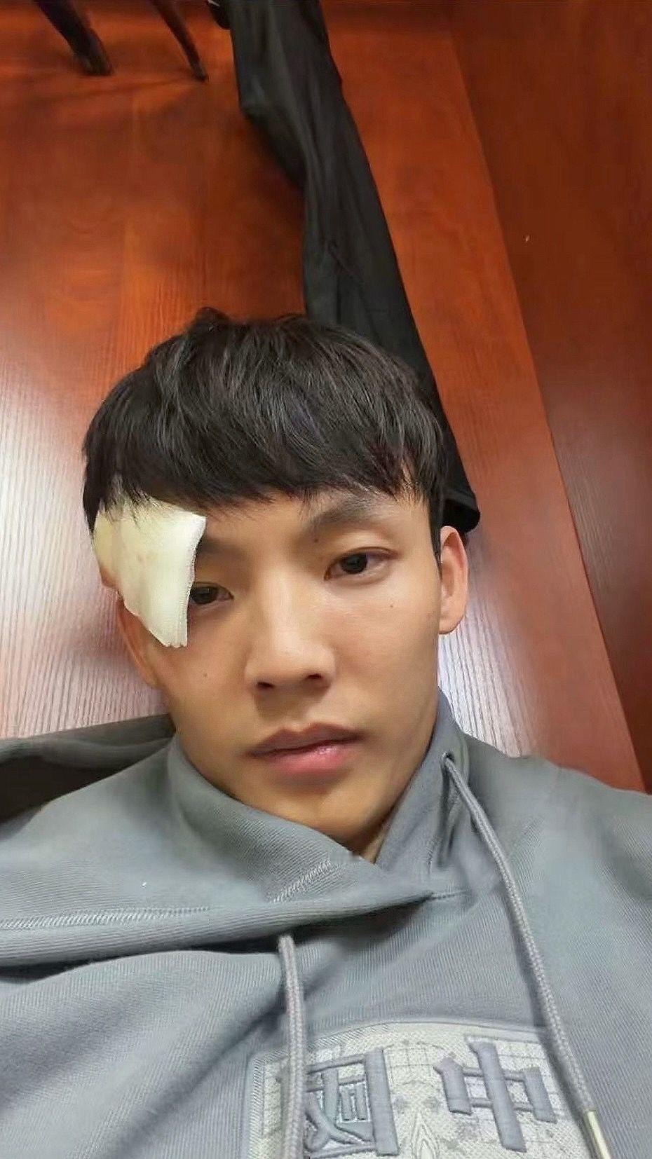 徐杰昨天比赛里受伤被送往医院，赛后发社交媒体报平安。昨天比赛，徐杰全场出战15分