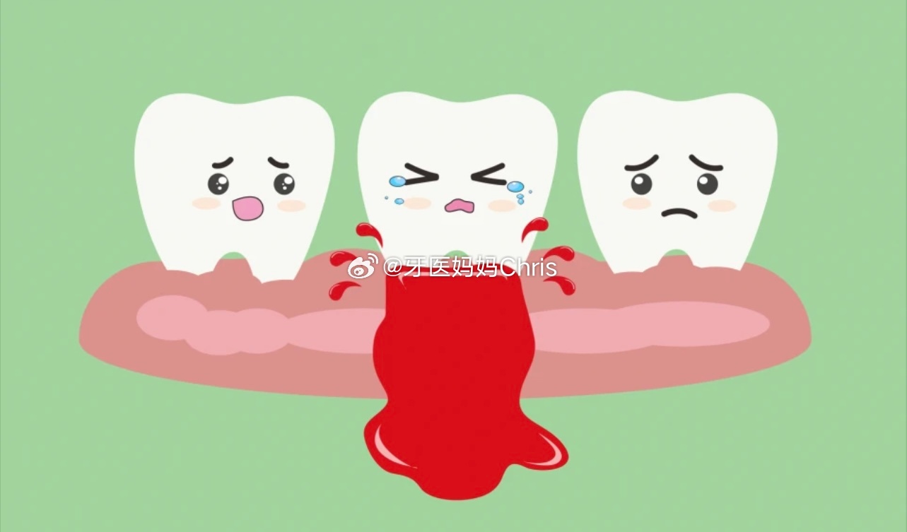 🌟不要轻视牙龈出血，可能是身体在报警🌟——解决【牙龈出血】你需要知道的那些事