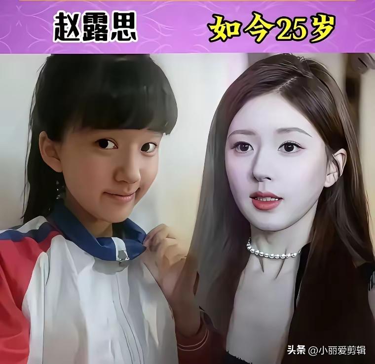 说真的，成名以前的确挺土的，走红后气质拔高
