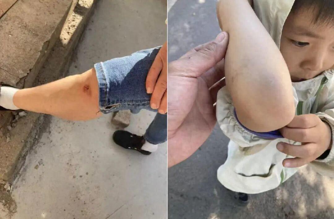 奶奶骑台铃电动车接6岁孙子，NFC解锁后方向突然锁死两人摔伤。九个月内摔了七八次