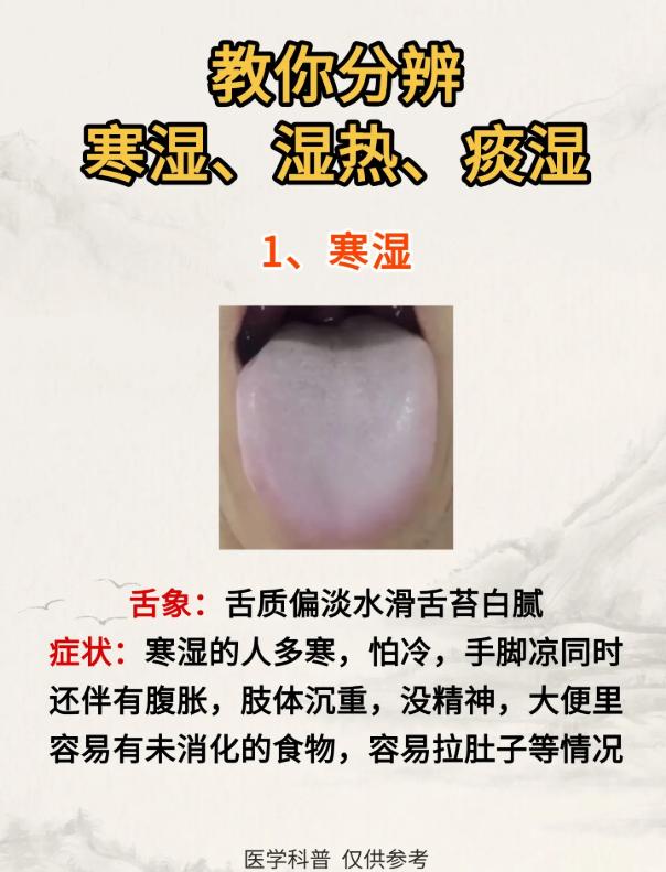 寒湿、湿热、痰湿如何区分？中医辨证要点