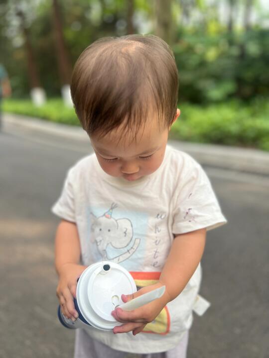 17月龄，这稀疏的头毛还有救吗？