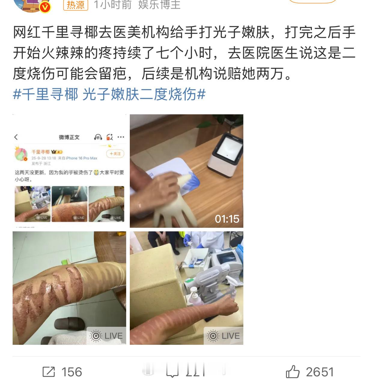 天呐好吓人，光子嫩肤不是最简单基础的医美吗咋还这样 千里寻椰 光子嫩肤二度烧伤 