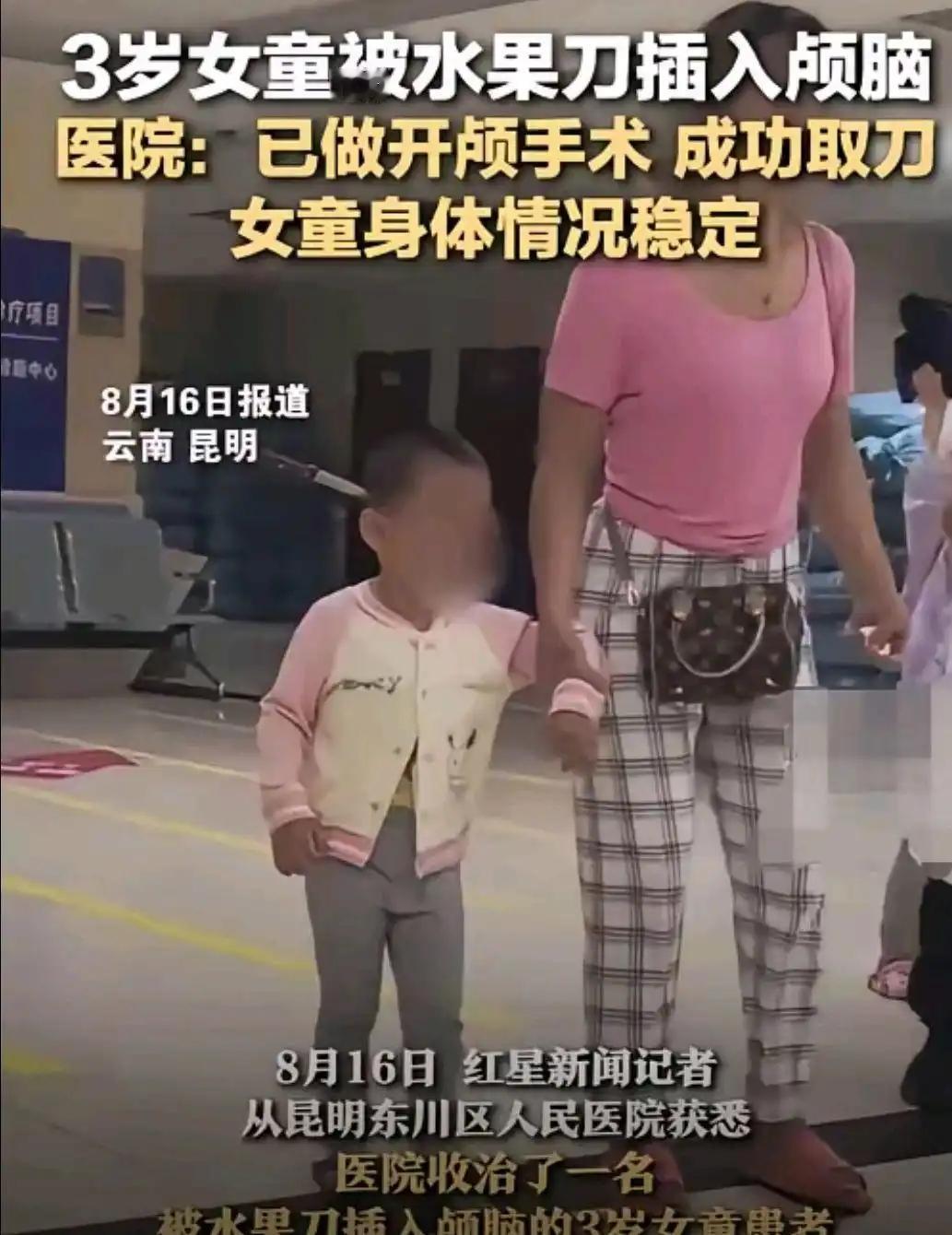 心真大！”云南昆明，3岁女孩玩耍时，不慎将水果刀插入头颅，妈妈看到后，没有慌也没