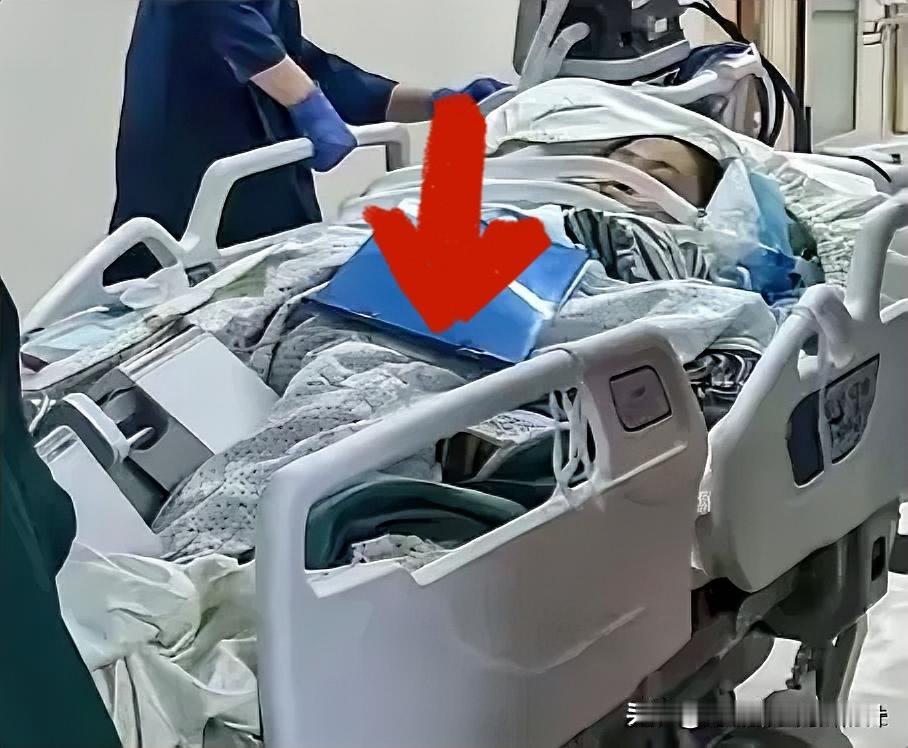 太可怕了，一碰致命的东西。
52岁阿姨在小区内散步，脚下踩破埋在土里的旧塑料壶，