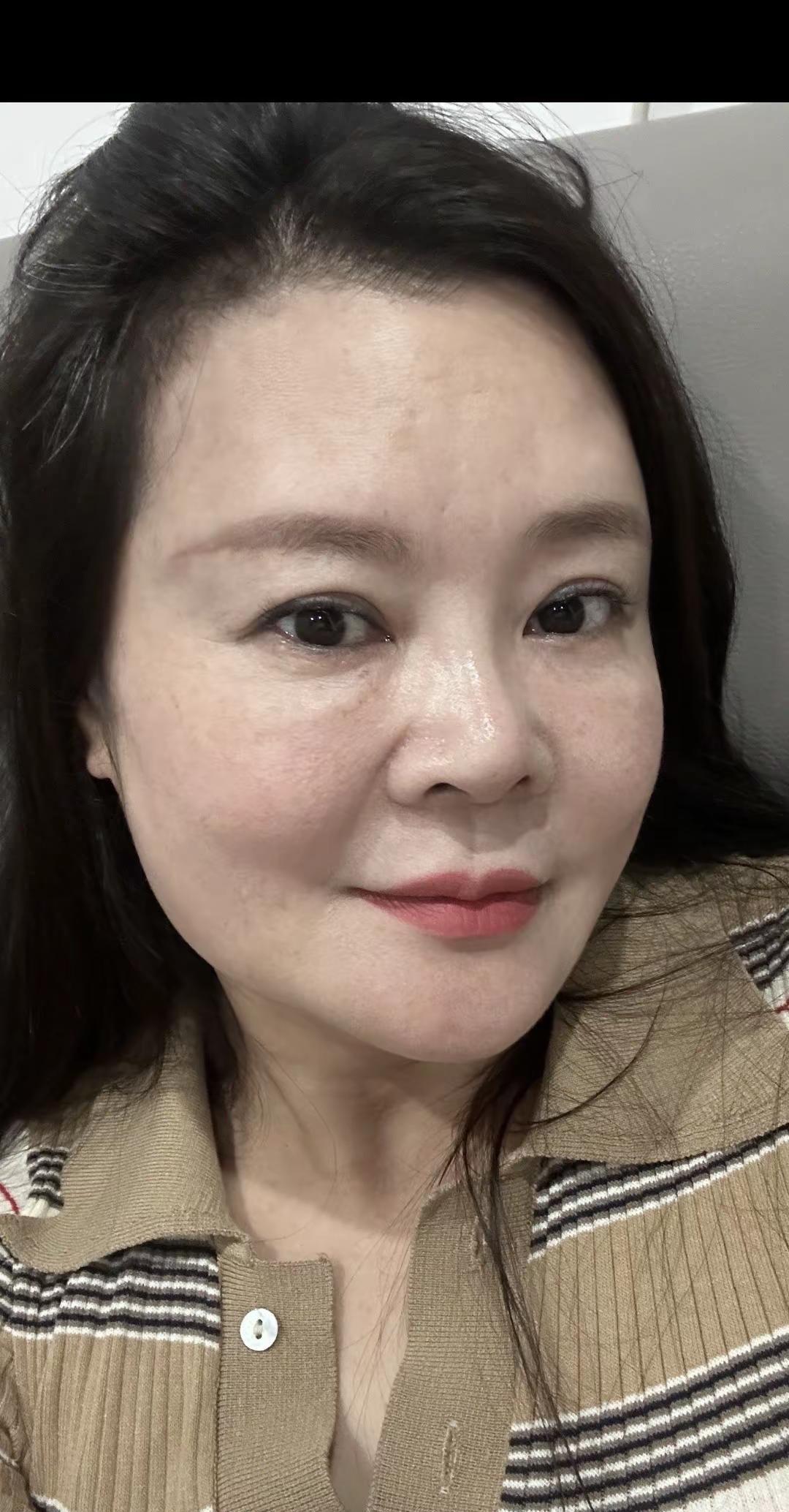 老去又如何，岁月饶过谁呢?你要允许自己脸上有皱纹，头上有白发，时间不会放过任何一