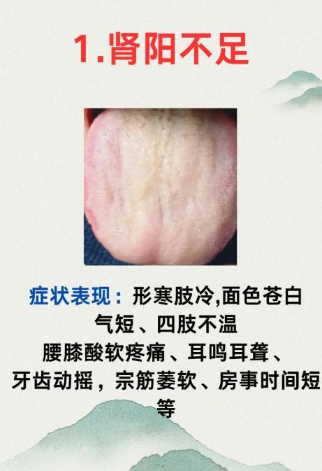 肾虚也分类型！看舌象对照，你是哪一种？