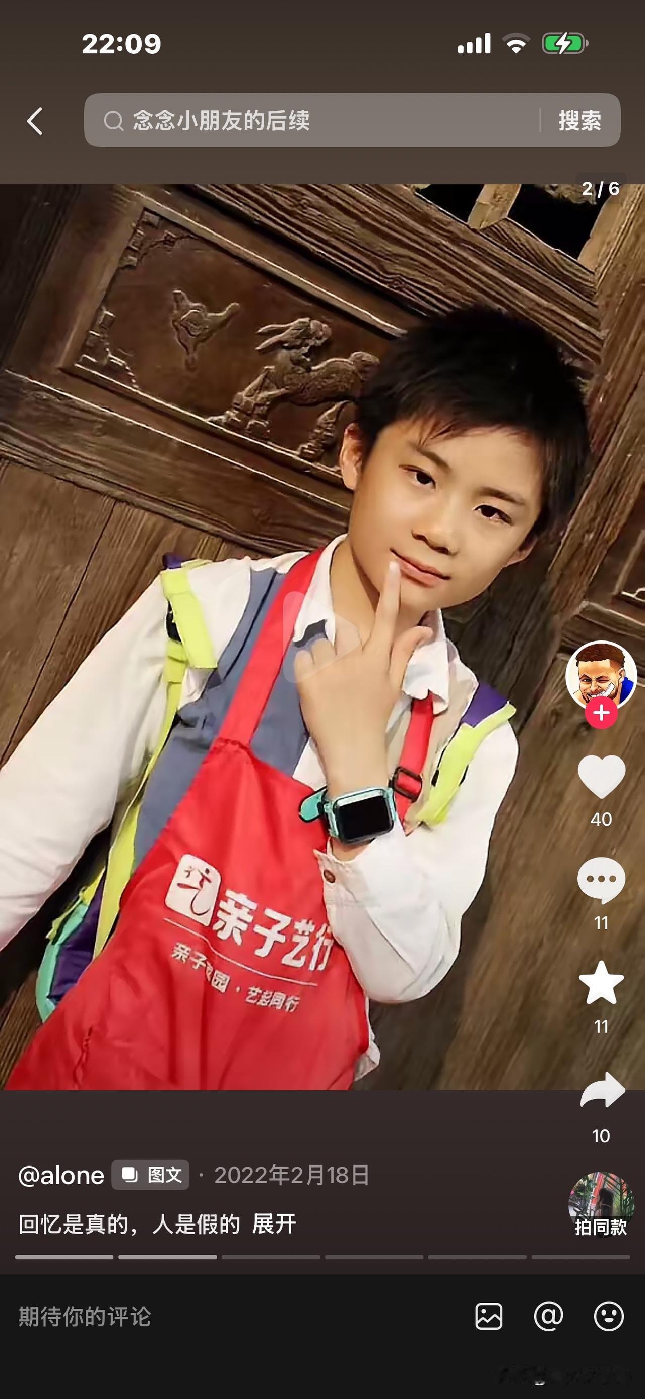 这孩子已不在了，走时12岁。
如不出意外，现已长成17岁的英俊少年。
爸爸缅怀：