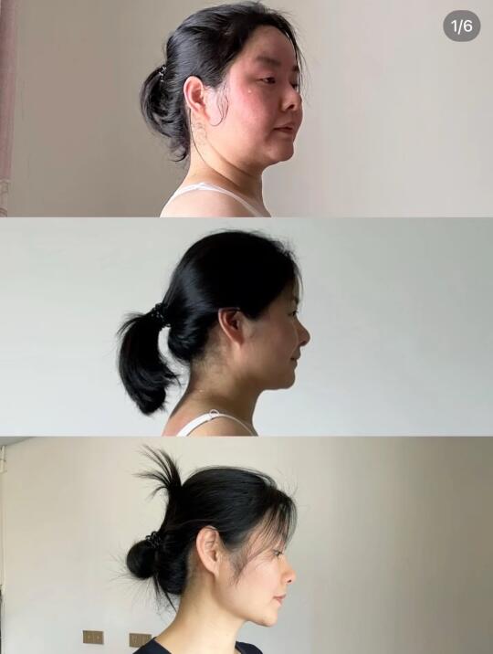 下颌线还得靠练背呀