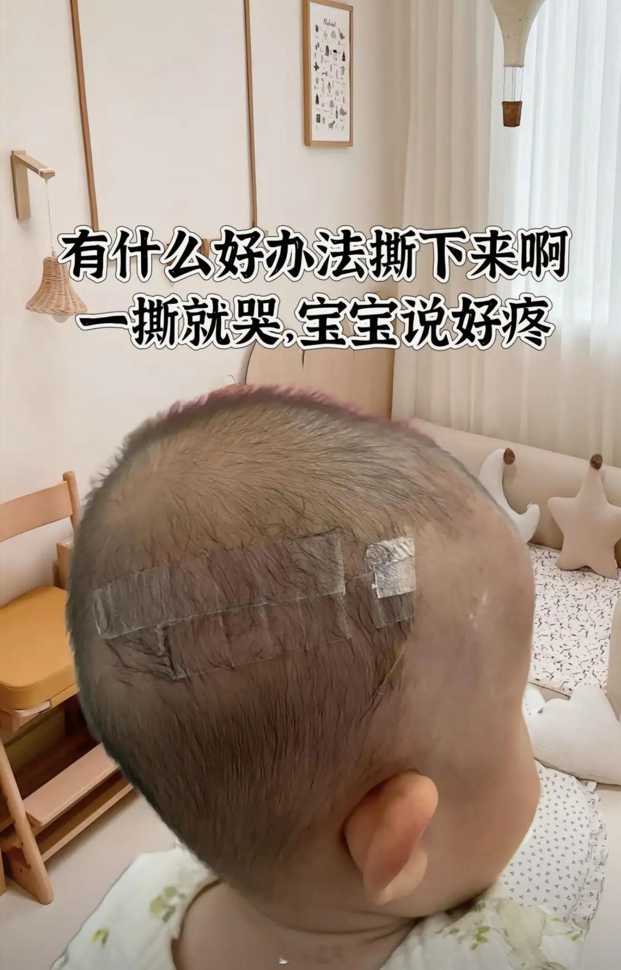 一撕就哭，有什么好办法吗？ 