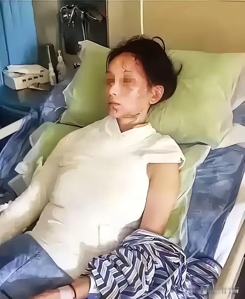 悲剧还是发生了！西安女子洗澡遭遇热水器爆炸，95%烫伤追责却无人担责？

日常洗