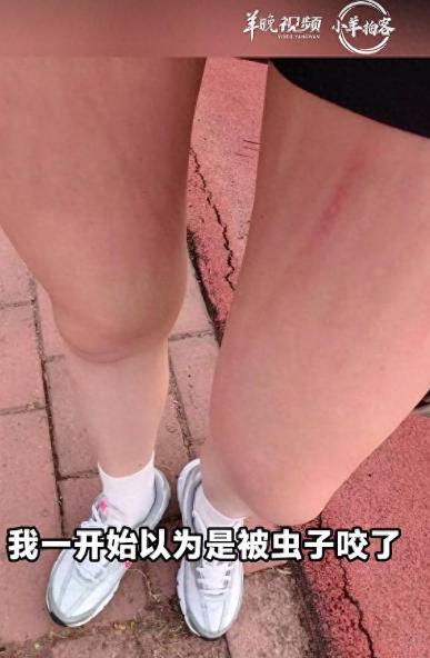 体育场女子，双腿突发钻心巨痒！
郑州一名女子晚上到体育场健身，只是慢悠悠走两圈热