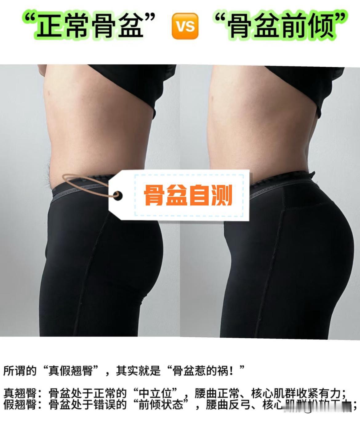 [灵光一闪]教你快速判断“骨盆前倾”的4种小技巧！

大家司空见惯的所谓“翘臀”