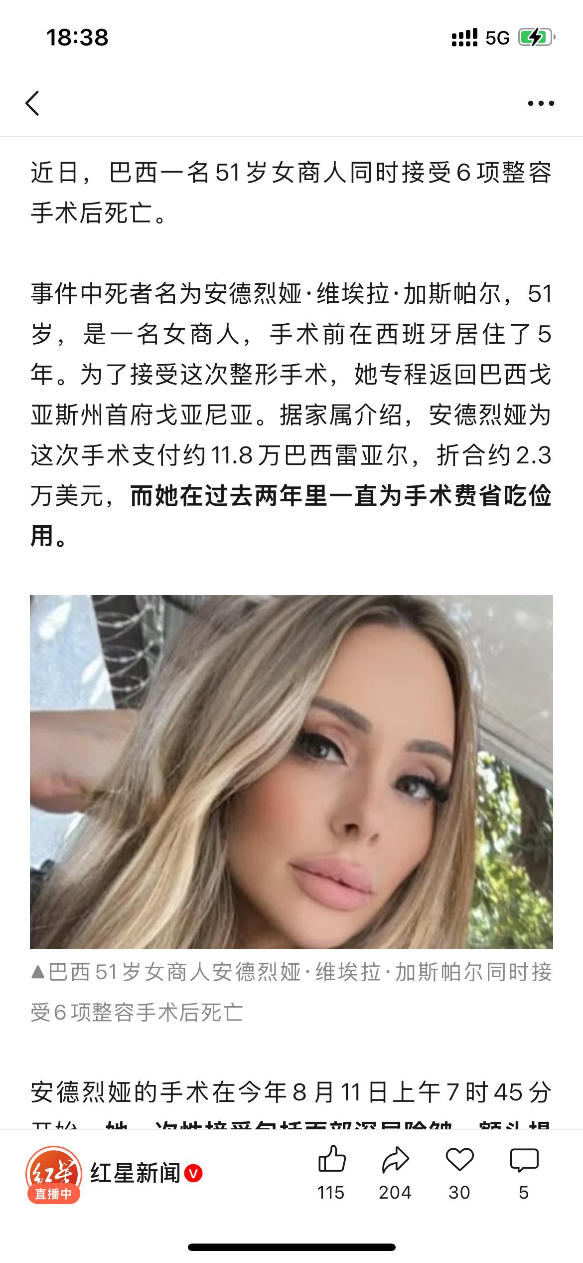 她一次性接受包括面部深层除皱、额头提升、颈部吸脂、眼睑整形、下巴/颏部调整等在内