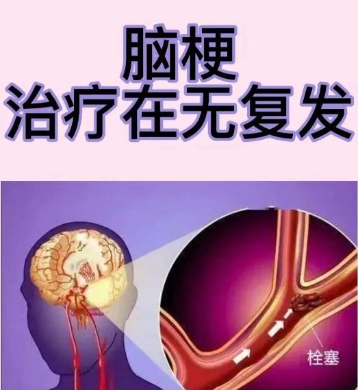 【五味狠药 打通脑梗血管 第五个最有效】

大家好，我是河南公立三甲医院的老中医