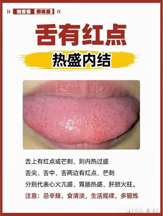 接诊最普遍的6大舌象，涵盖80%的人群
简单对图辩证，一分钟了解自身体质
张医生