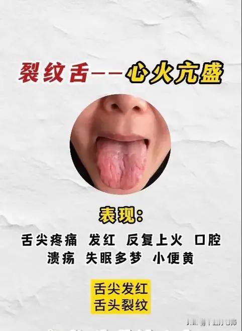 舌裂纹也分很多种，你知道吗？中医一次给你讲清楚#健康##舌诊#