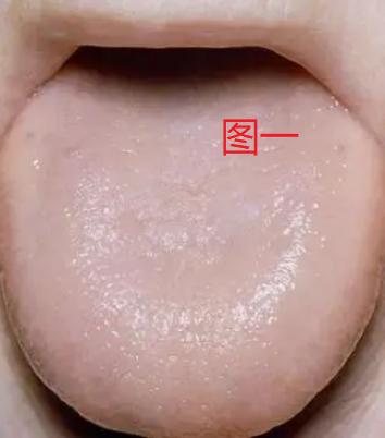 5个祛湿“超猛”的药，吸干一身湿气，[谢谢][谢谢][谢谢]

一、祛肺湿——【