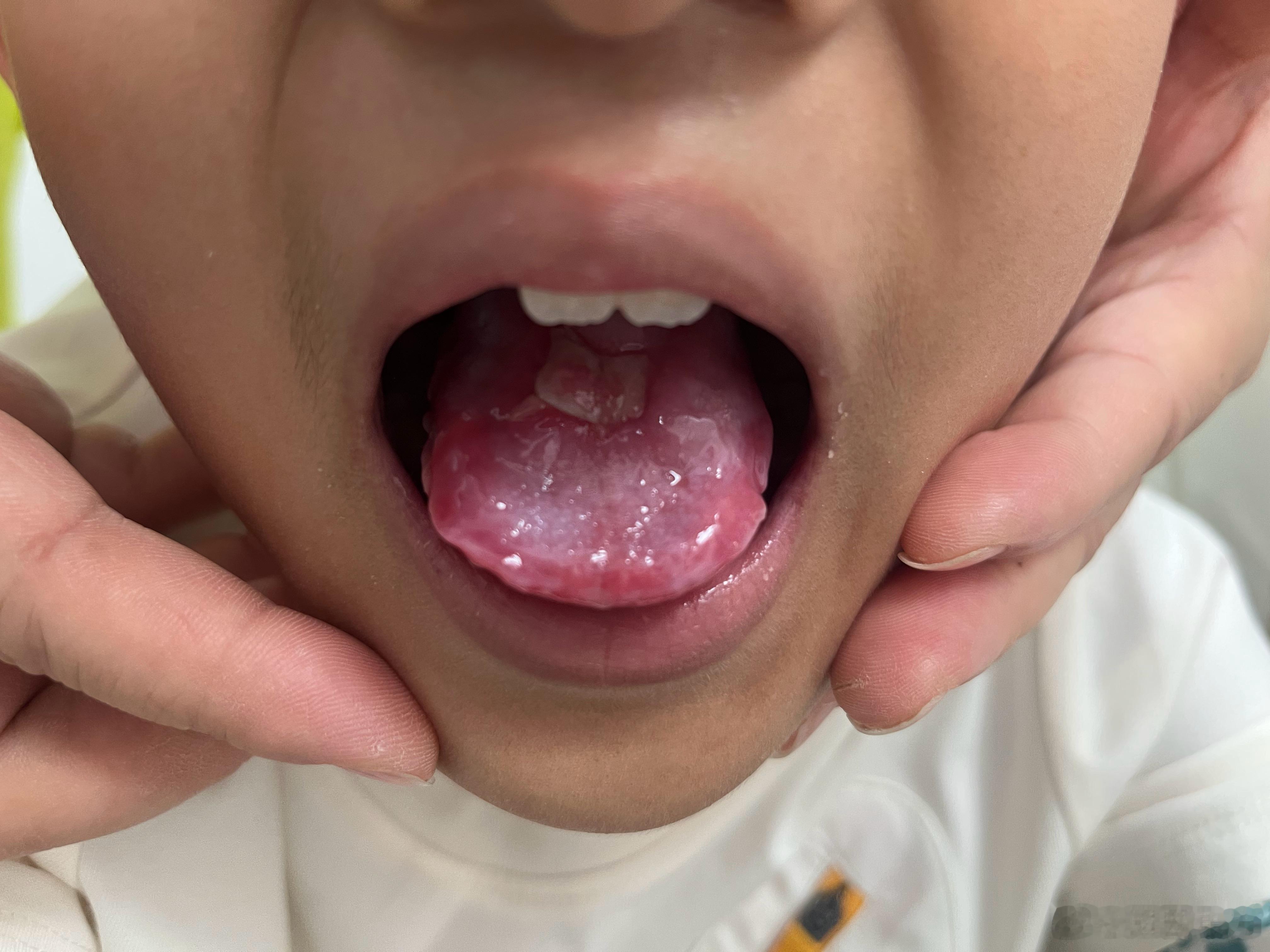 先天性角化不良症 的中医思路先天性角化不良症，现代医学尚无根治之法，那么中医可有