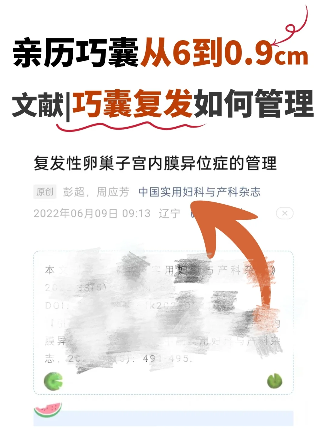 巧囊如何防复发？认真看这篇论文就懂了