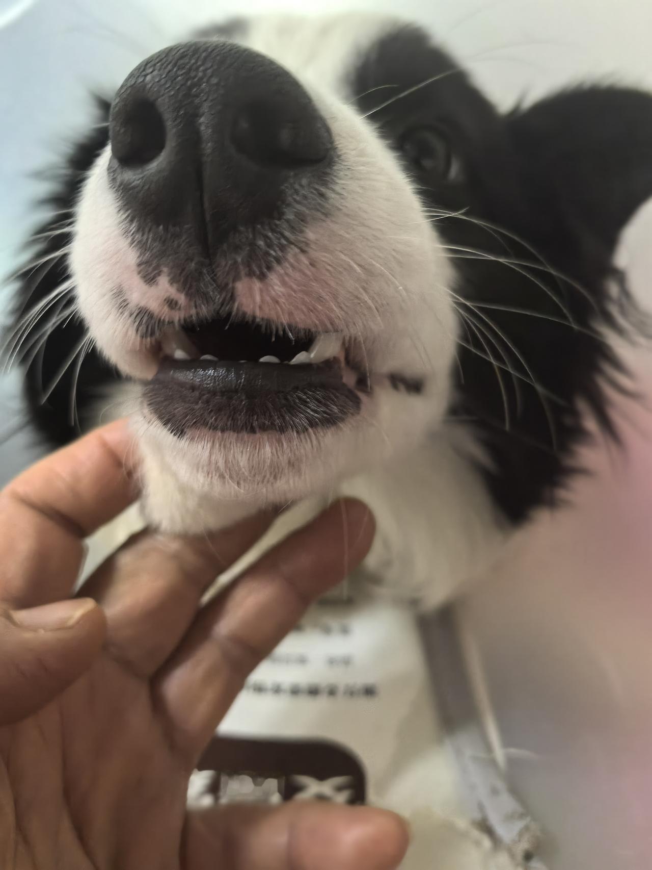 今天去牙科复诊看牙医，

医生仔细检查了一下我的牙齿，

告诉我，牙齿根管治疗装