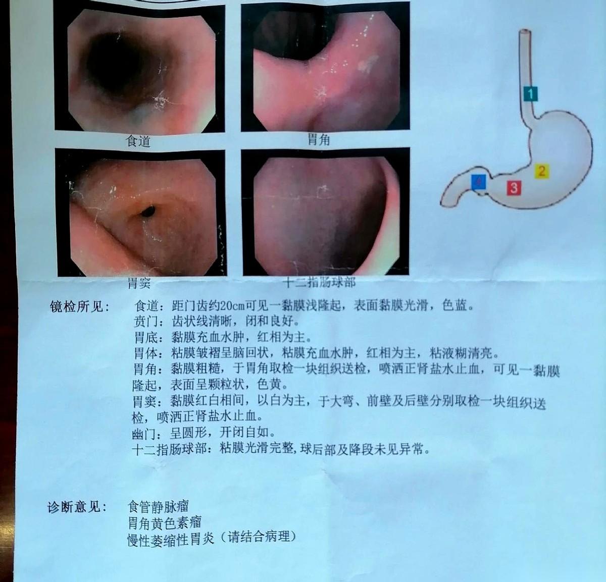 那张报告单拿到手，我来来回回看了三遍。
就那几行字，怎么看怎么陌生，好像说的不是