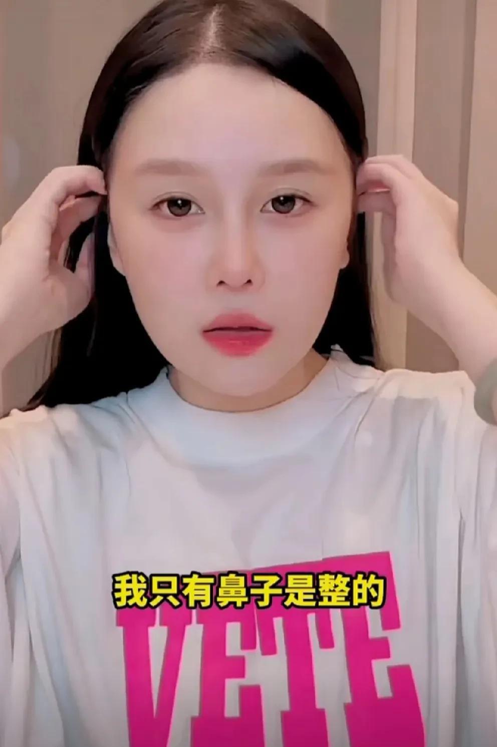突然整容？别轻易尝试，后果可不简单！在社交媒体上，名人整容已经屡见不鲜。然而一位