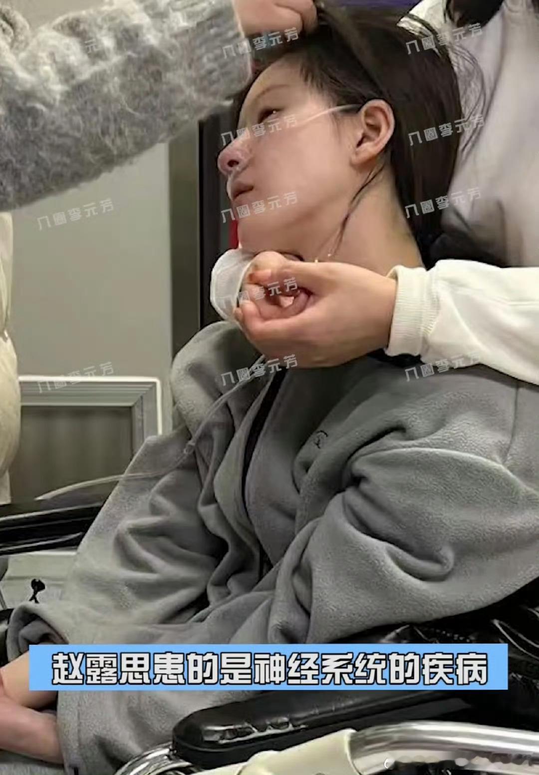 赵露思就诊画面 好好的艺人进组拍戏，到底是经历了什么会变成这个样子？？如果不被拍