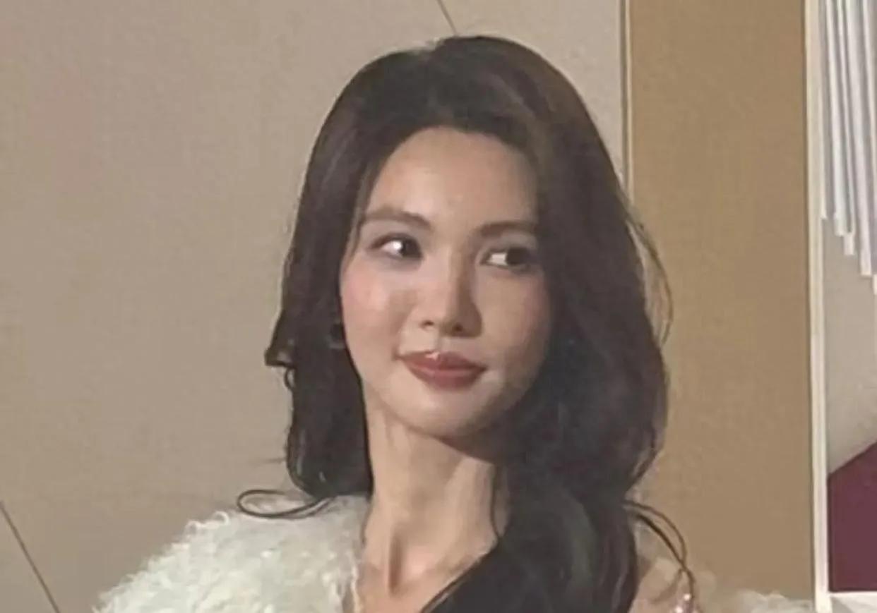 金晨面部状态变了！出席活动裹一身皮草，脸又肿又僵惹质疑！