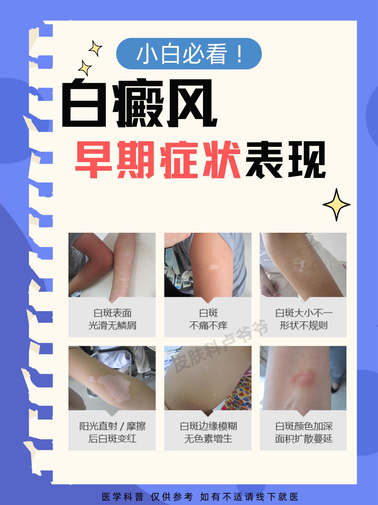 白癜风的早期症状，快来检查一下