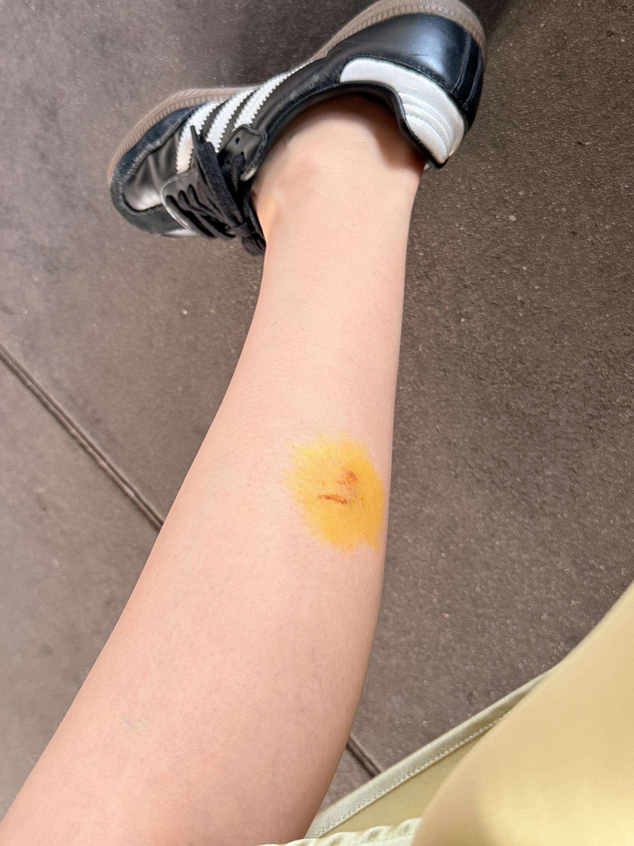 虽然在公园被长尾猴抓伤了 但是转念一想，终于可以用上付航这段语录了