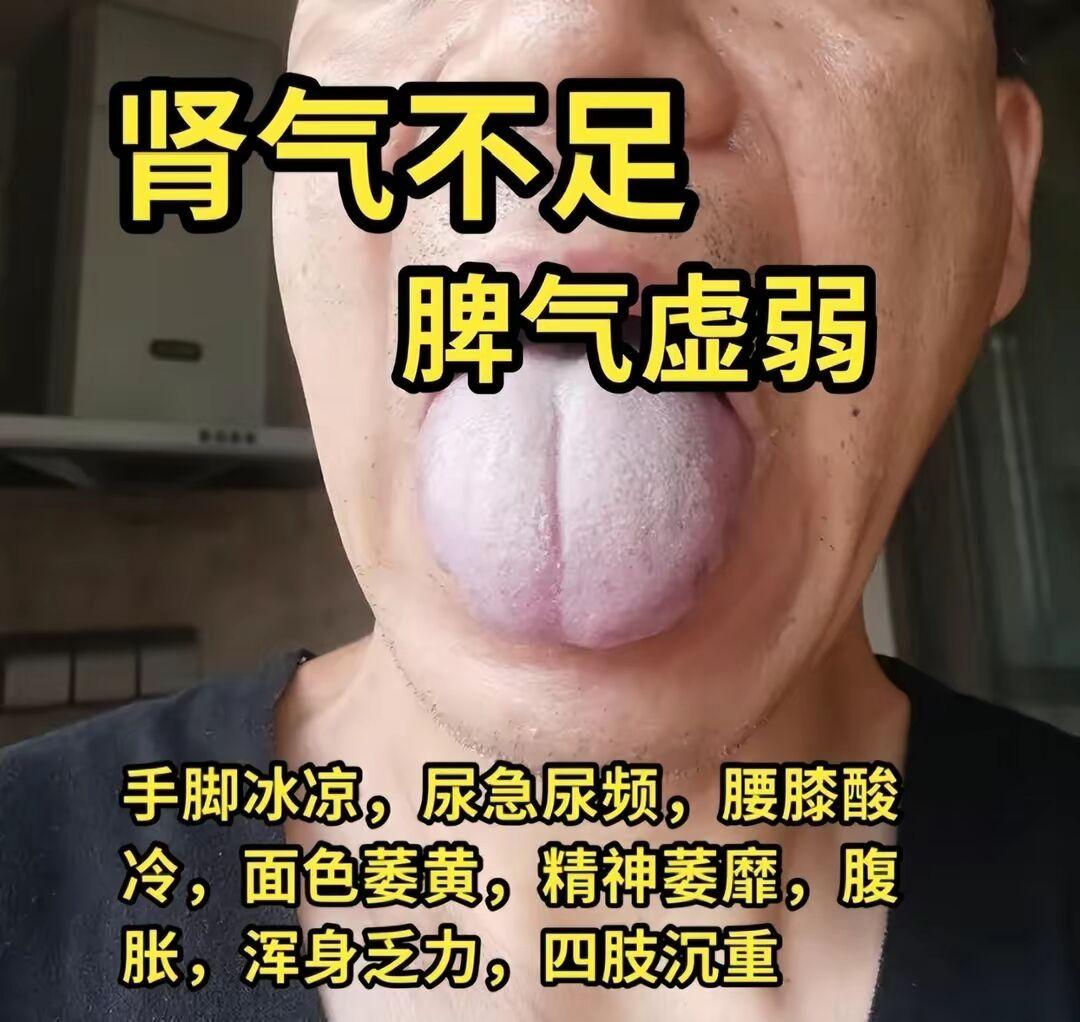 薛医生揭秘舌诊之谜 肾气不足、肾阳不足、脾肾阳虚、肾阴亏虚
深入解读舌诊之谜，带