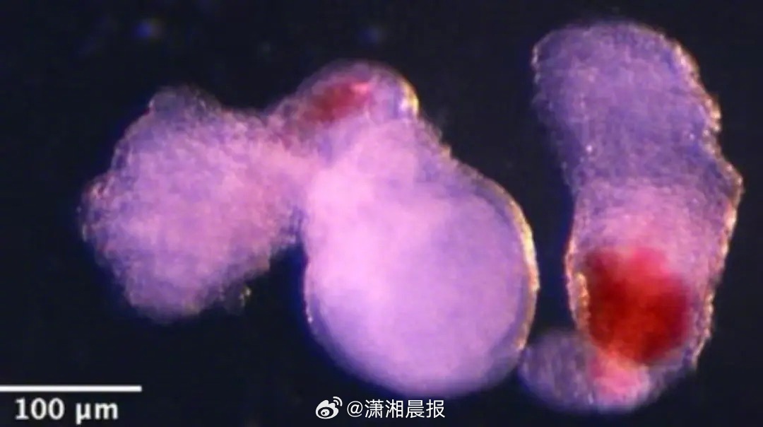 【#科学家实验首次产生人类血细胞#，可望用于骨髓移植】英国剑桥大学科学家在实验室